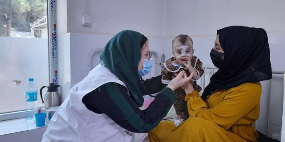 無國界醫生在阿富汗的小兒科醫生治療營養不良兒童