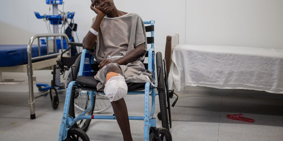 克勞德Claudette在住家附近遭受流彈攻擊，由於未能及時就醫引發感染，在無國界醫生支援的泰巴爾醫院接受截肢手術。©MSF/Alexandre Marcou