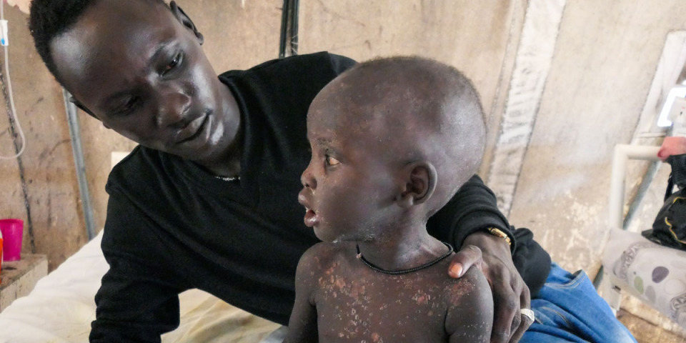 來自蘇丹的努恩（Noon Mayom）與他的孩子在南蘇丹無國界醫生的麻疹隔離病房。©Gale Julius Dada/MSF