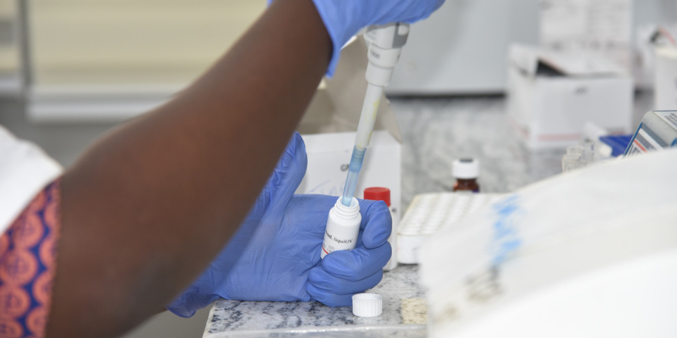 一名無國界醫生員工正在進行結核病生化檢測。© MSF/Ammar Obeidat