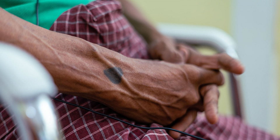 在仰光的愛滋諮詢服務。病患手上的心形刺青。© MSF/BEN SMALL
