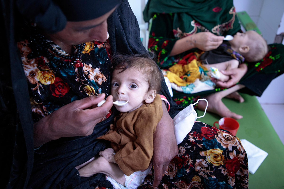 2021yip-06-afghanistan-malnutrition.jpg